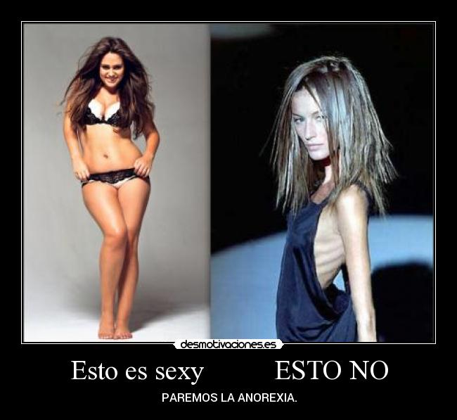 Esto es sexy          ESTO NO - PAREMOS LA ANOREXIA.