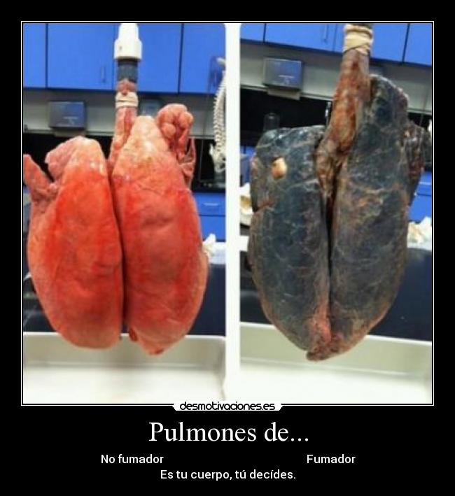 Pulmones de... -