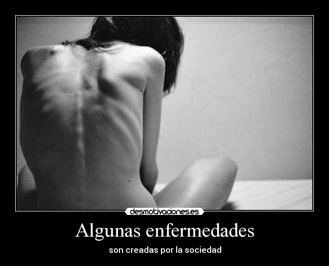Algunas enfermedades - son creadas por la sociedad
