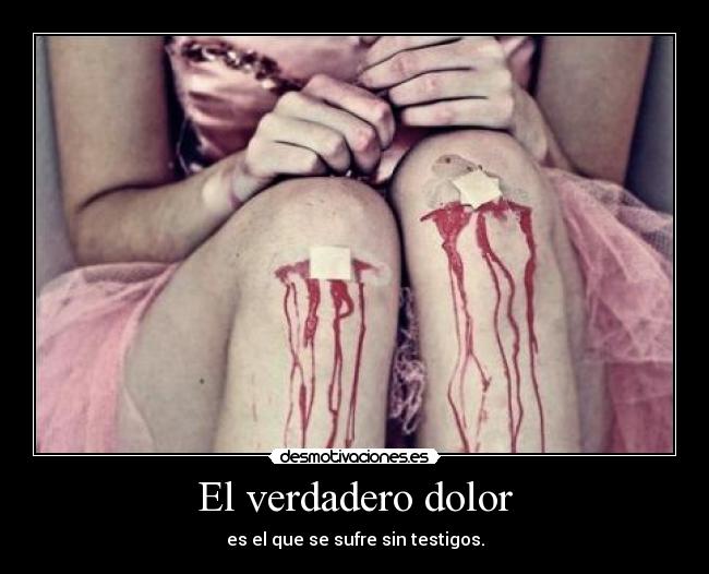 El verdadero dolor - 