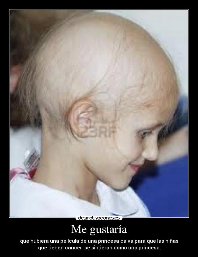 Me gustaría - que hubiera una película de una princesa calva para que las niñas
que tienen cáncer se sintieran como una princesa.