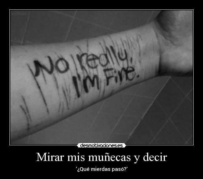 Mirar mis muñecas y decir - ¿Qué mierdas pasó?