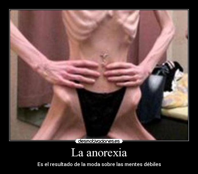 La anorexia -