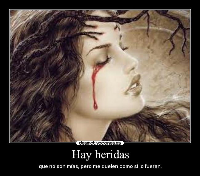 Hay heridas -
