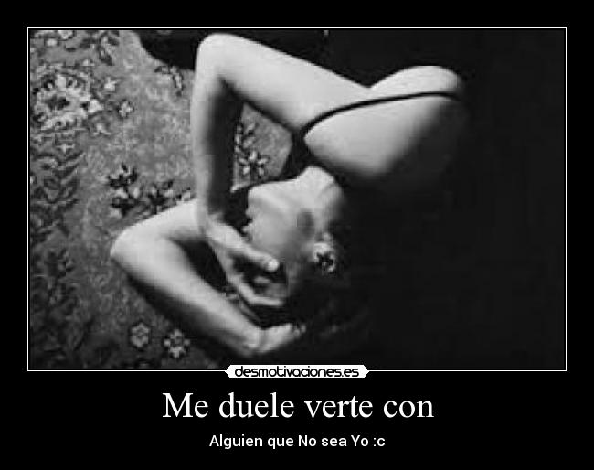 Me duele verte con - Alguien que No sea Yo :c