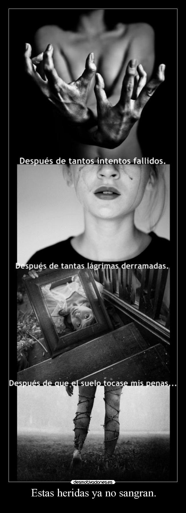 Estas heridas ya no sangran. - 