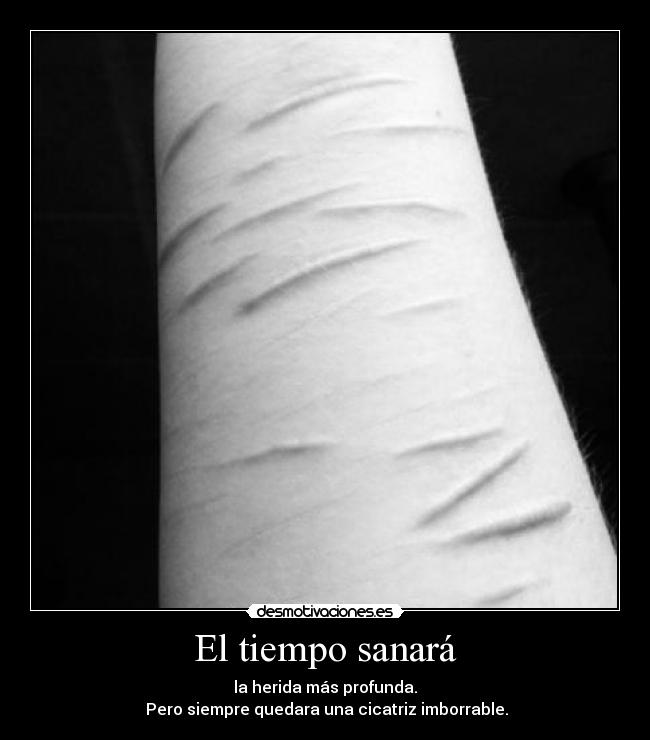 El tiempo sanará - la herida más profunda.
Pero siempre quedara una cicatriz imborrable.