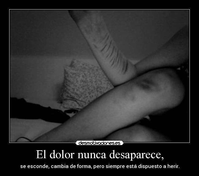 El dolor nunca desaparece, - 