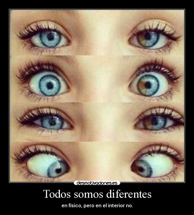 Todos somos diferentes -