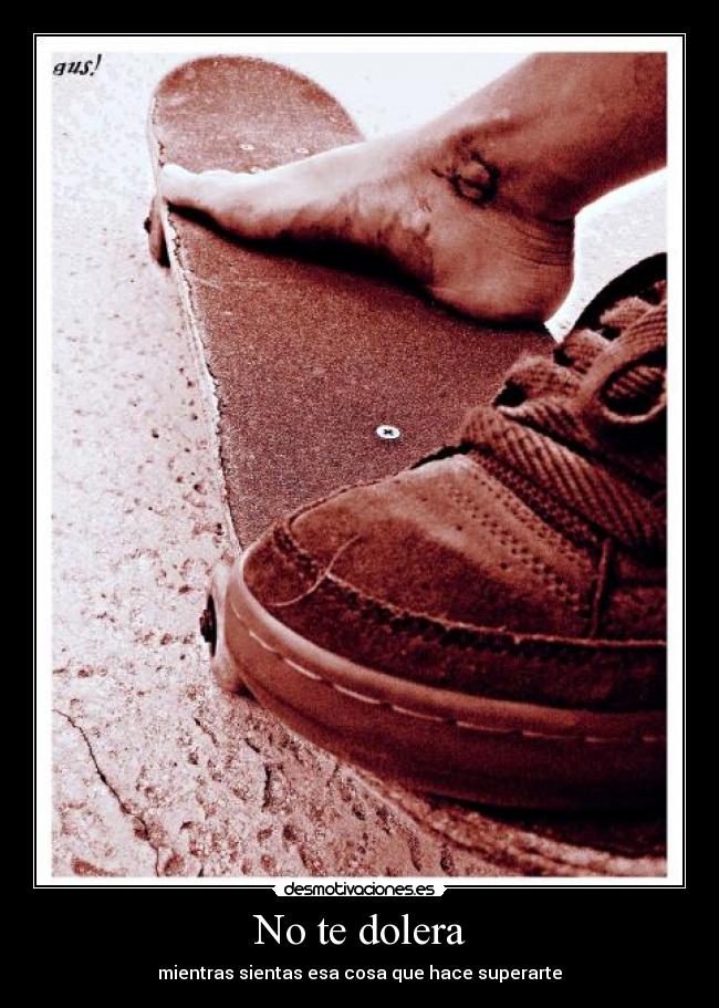 No te dolera - 