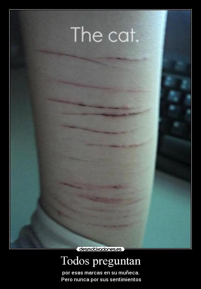 Todos preguntan - por esas marcas en su muñeca.
Pero nunca por sus sentimientos