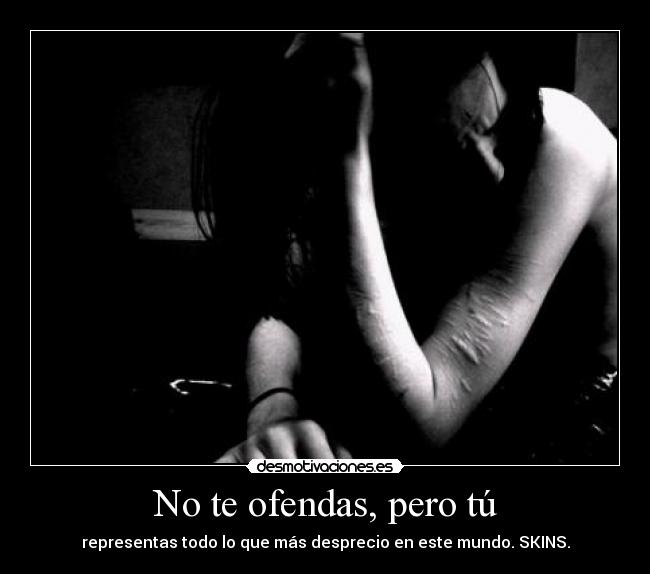 No te ofendas, pero tú - representas todo lo que más desprecio en este mundo. SKINS.
