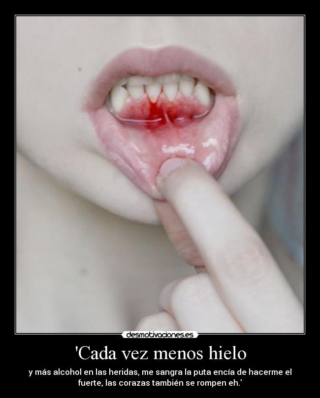 Cada vez menos hielo - y más alcohol en las heridas, me sangra la puta encía de hacerme el
fuerte, las corazas también se rompen eh.