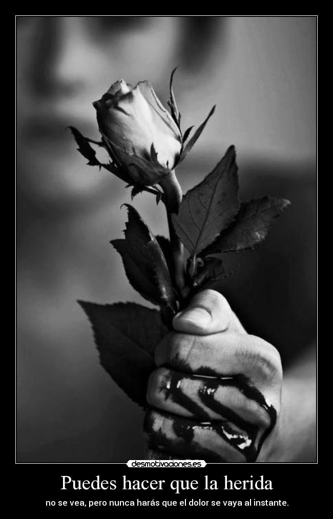 Puedes hacer que la herida - 