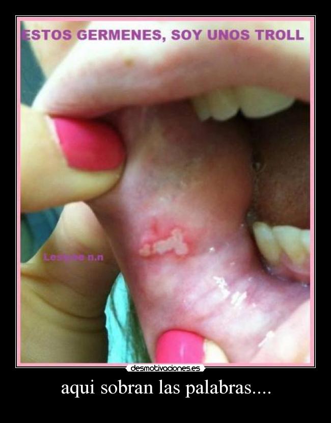 aqui sobran las palabras.... - 