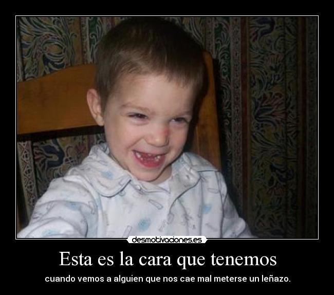 Esta es la cara que tenemos - cuando vemos a alguien que nos cae mal meterse un leñazo.