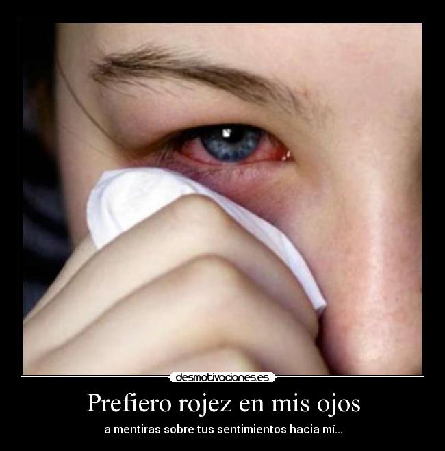 Prefiero rojez en mis ojos - 