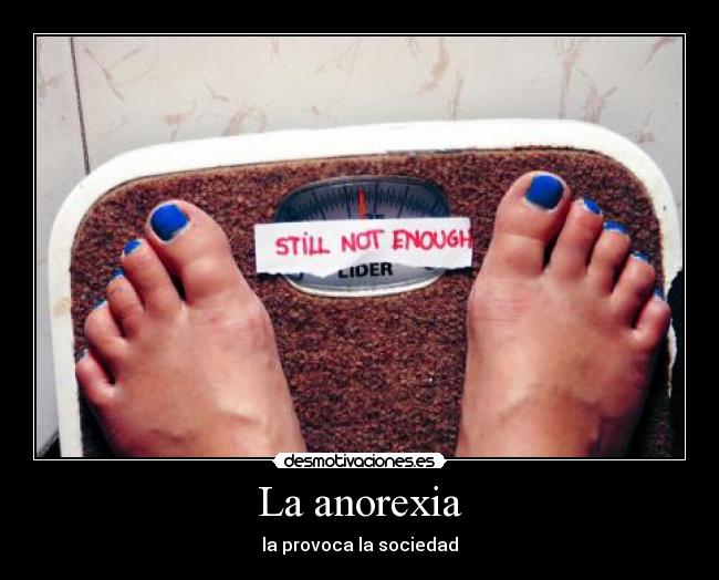 La anorexia -