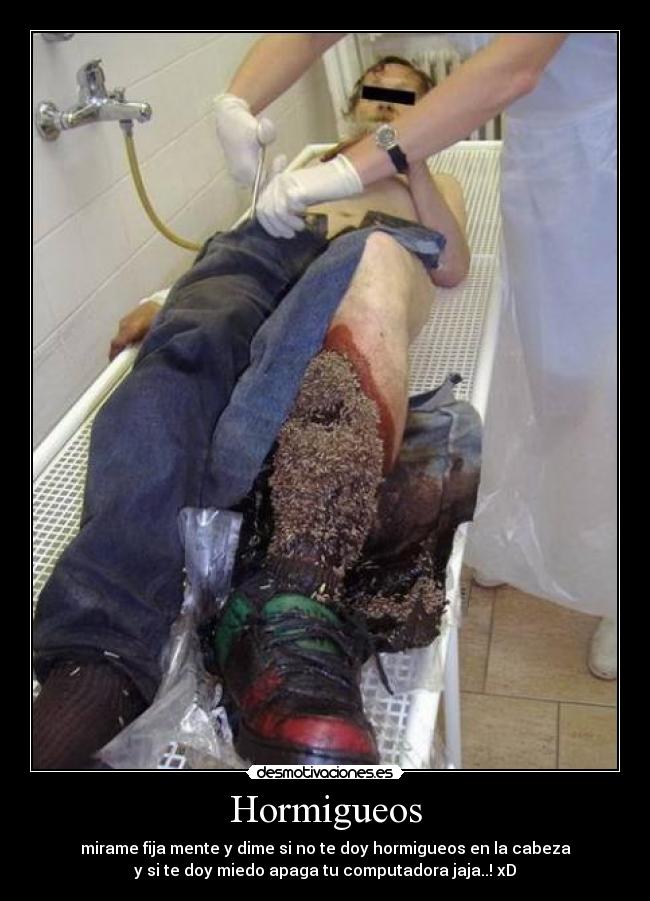 Hormigueos -