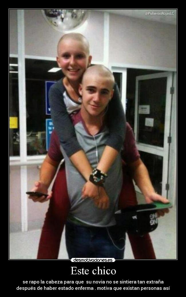 Este chico - se rapo la cabeza para que  su novia no se sintiera tan extraña
después de haber estado enferma . motiva que existan personas así