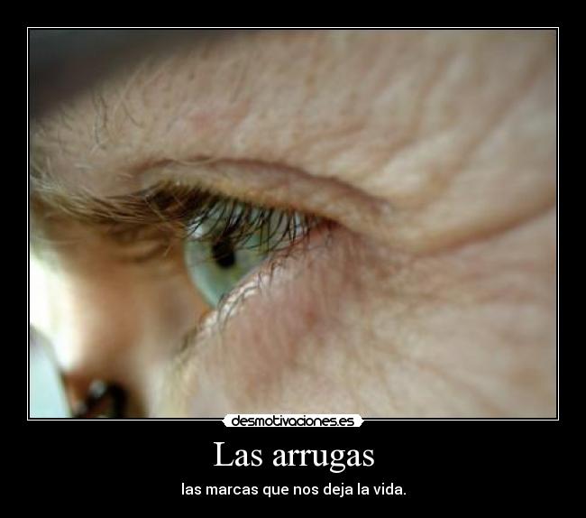 Las arrugas -