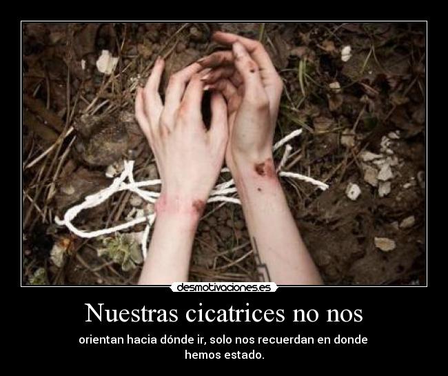 Nuestras cicatrices no nos - orientan hacia dónde ir, solo nos recuerdan en donde
hemos estado.