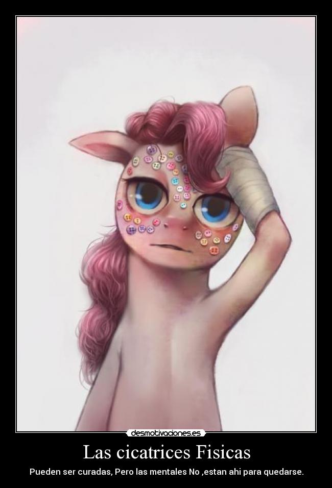 Las cicatrices Fisicas - Pueden ser curadas, Pero las mentales No ,estan ahi para quedarse.