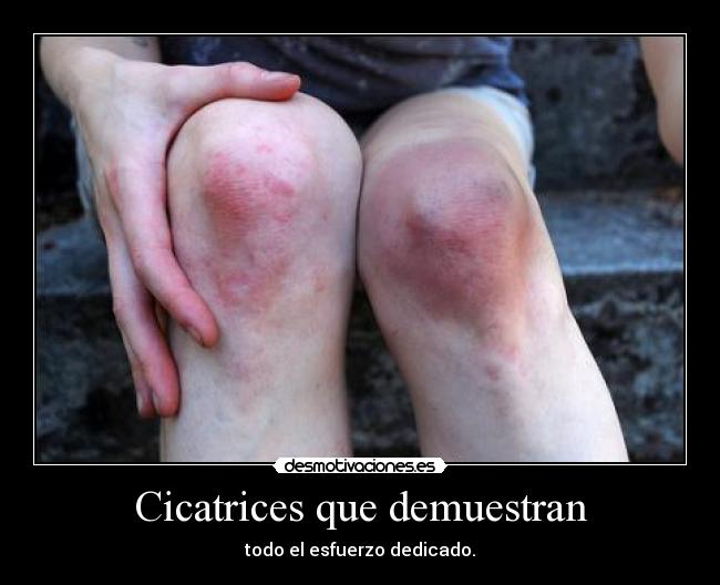 Cicatrices que demuestran - 