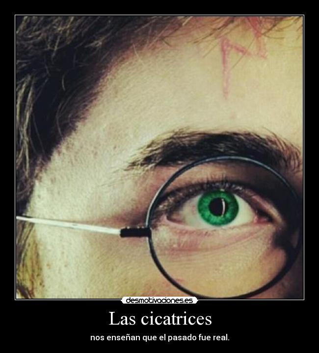 Las cicatrices - nos enseñan que el pasado fue real.