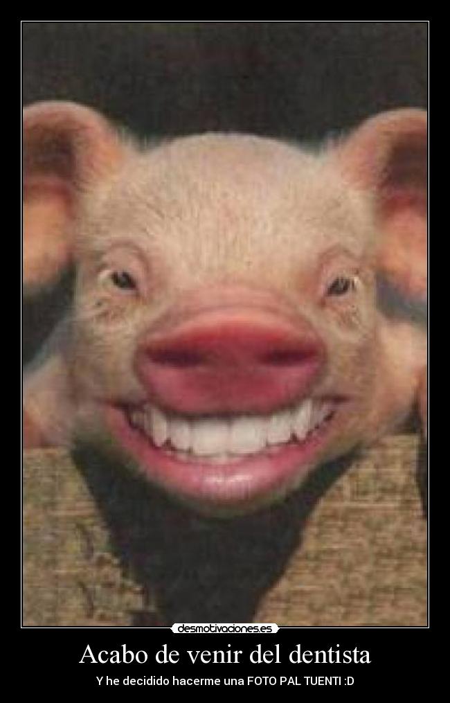 Acabo de venir del dentista - Y he decidido hacerme una FOTO PAL TUENTI :D