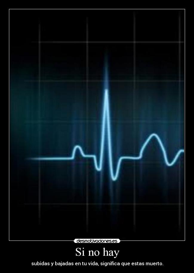 Si no hay - subidas y bajadas en tu vida, significa que estas muerto.