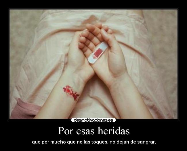 Por esas heridas - que por mucho que no las toques, no dejan de sangrar.