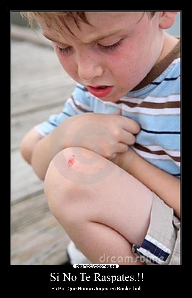 Si No Te Raspates.!! -
