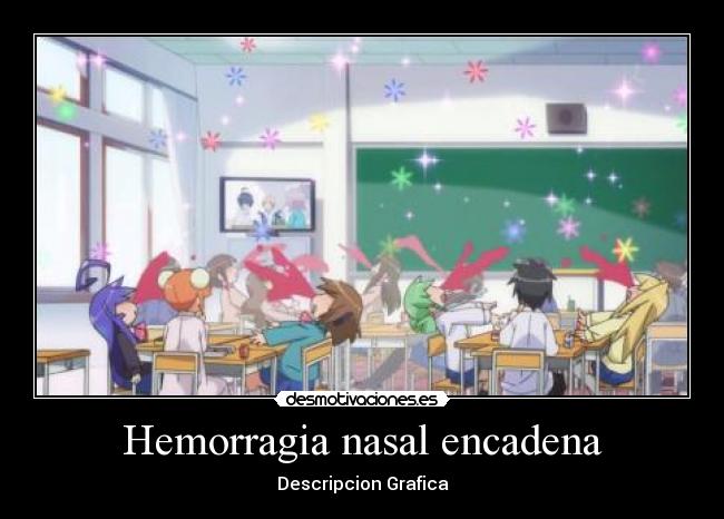 Hemorragia nasal encadena - 