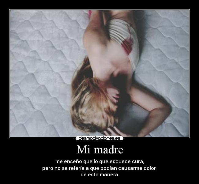 Mi madre - me enseño que lo que escuece cura,
pero no se refería a que podían causarme dolor
de esta manera.