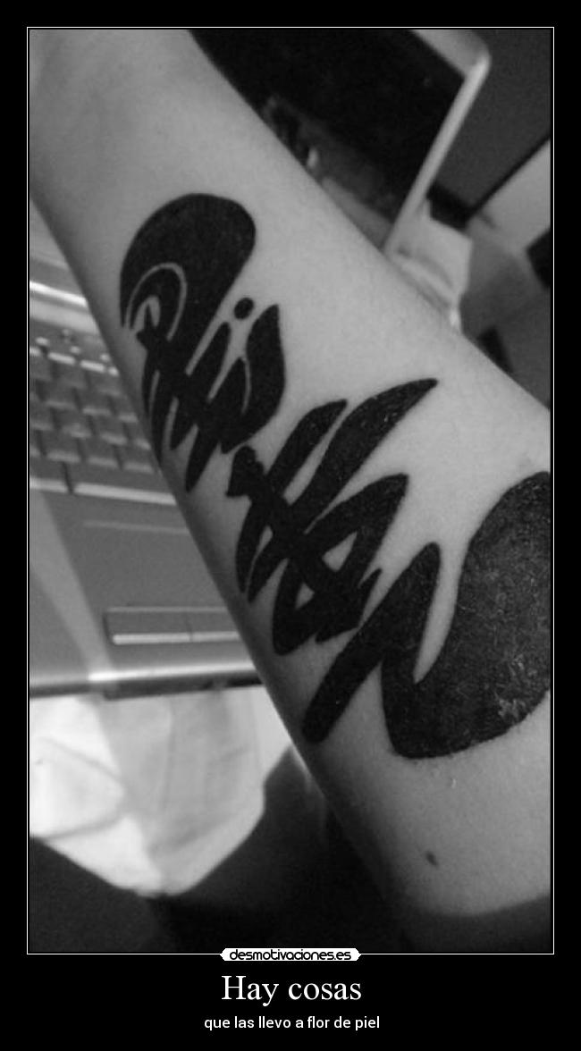 Hay cosas - que las llevo a flor de piel