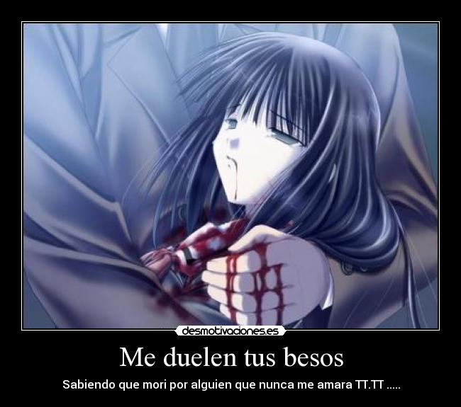 Me duelen tus besos -