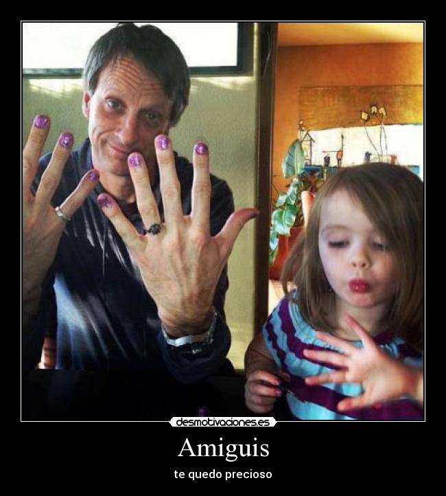 Amiguis - te quedo precioso