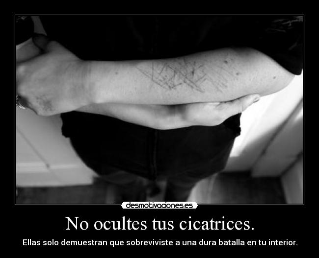 No ocultes tus cicatrices. -