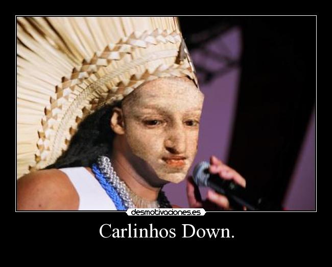 Carlinhos Down. - 