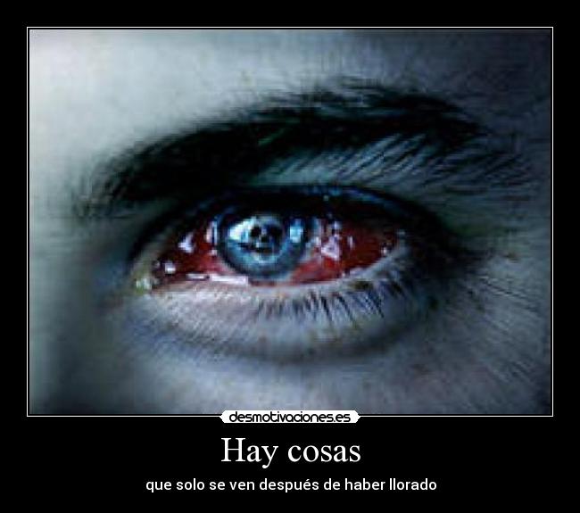 Hay cosas - 