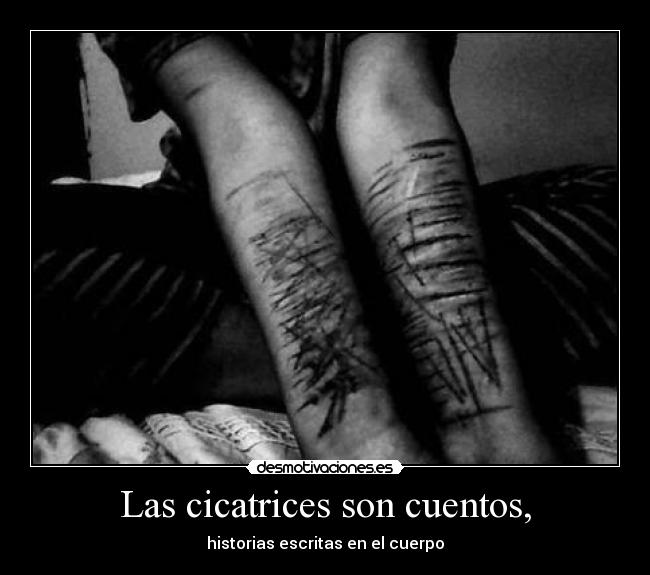 Las cicatrices son cuentos, - historias escritas en el cuerpo