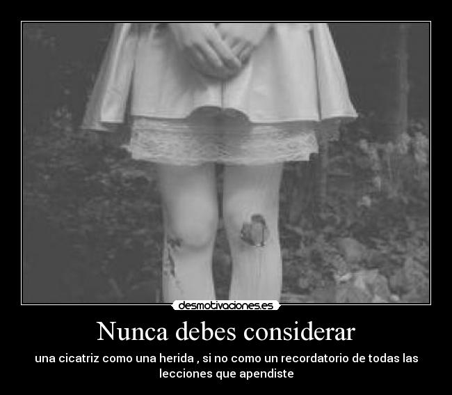 Nunca debes considerar - una cicatriz como una herida , si no como un recordatorio de todas las
lecciones que apendiste