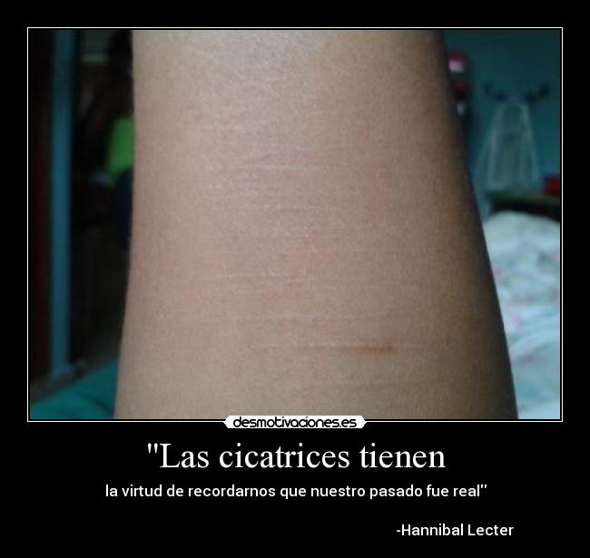 Las cicatrices tienen - la virtud de recordarnos que nuestro pasado fue real
-Hannibal Lecter