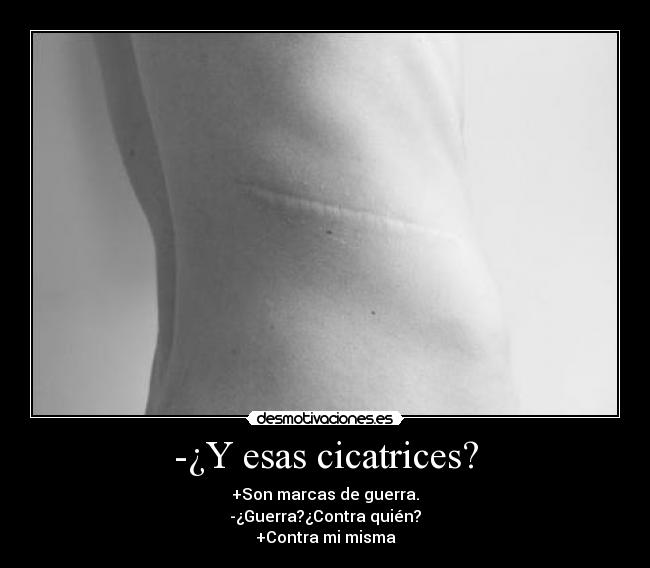 -¿Y esas cicatrices? - +Son marcas de guerra.
-¿Guerra?¿Contra quién?
+Contra mi misma