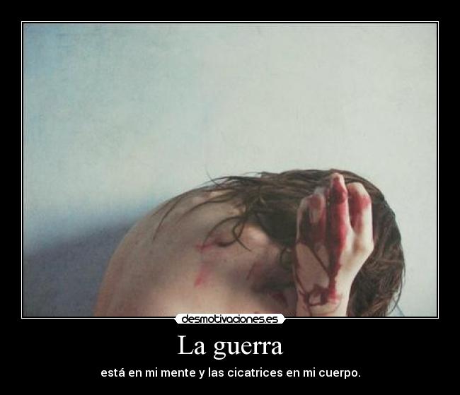 La guerra - 