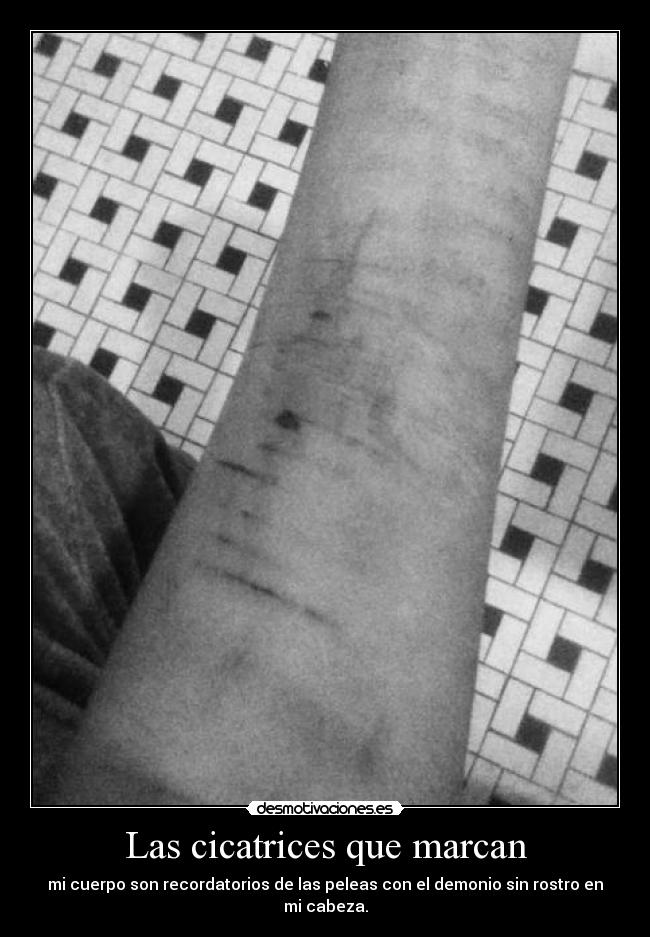 Las cicatrices que marcan - mi cuerpo son recordatorios de las peleas con el demonio sin rostro en mi cabeza.