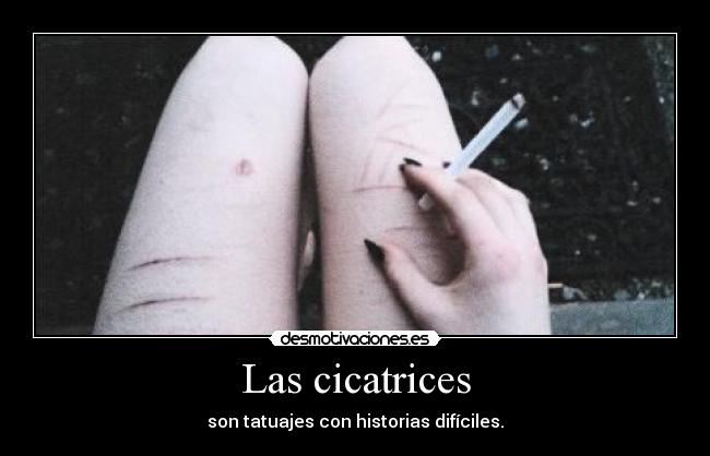 carteles cicatrices selfharm cigarro depresion triste tatuajes tatoos desmotivaciones