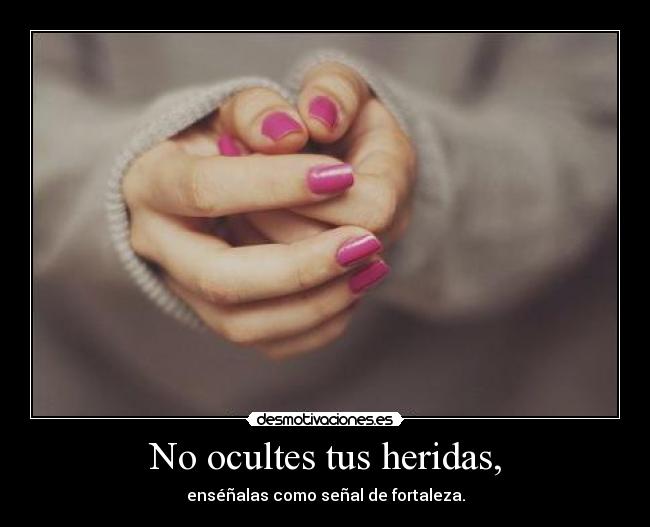 No ocultes tus heridas, - enséñalas como señal de fortaleza.