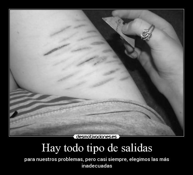Hay todo tipo de salidas -